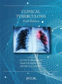 Cover image for Clinical Tuberculosis