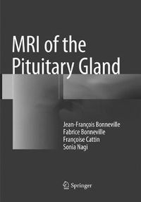 Cover image for MRI of the Pituitary Gland