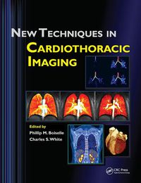 Cover image for New Techniques in Cardiothoracic Imaging