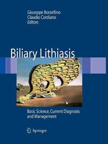 Cover image for Biliary Lithiasis: Basic Science, Current Diagnosis and Management
