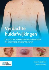 Cover image for Verdachte Huidafwijkingen: Casuistiek, Differentiaaldiagnoses En Achtergrondinformatie