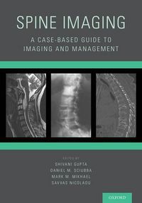 Cover image for Spine Imaging: A Case-Based Guide to Imaging and Management