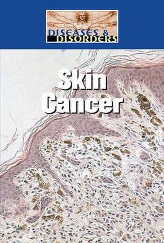 Cover image for Skin Cancer