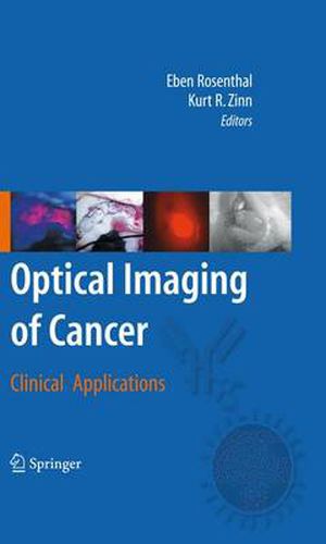 Cover image for Optical Imaging of Cancer: Clinical Applications