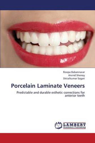 Cover image for Porcelain Laminate Veneers