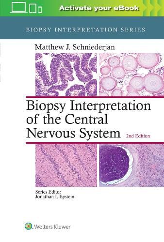 Cover image for Biopsy Interpretation of the Central Nervous System