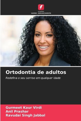 Cover image for Ortodontia de adultos