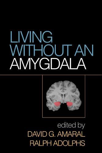 Cover image for Living without an Amygdala