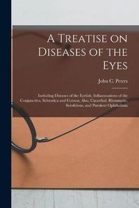 Cover image for A Treatise on Diseases of the Eyes; Including Diseases of the Eyelids, Inflammations of the Conjunctiva, Sclerotica and Cornea; Also, Catarrhal, Rheumatic, Scrofulous, and Purulent Ophthalmia