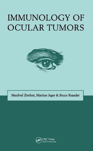 Cover image for Immunology of Ocular Tumors