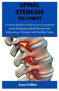 Cover image for Spinal Stenosis Treatment