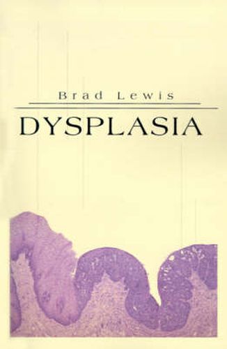 Cover image for Dysplasia