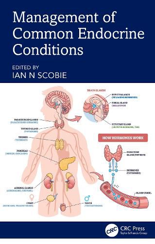 Cover image for Management of Common Endocrine Conditions