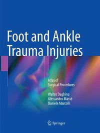 Cover image for Foot and Ankle Trauma Injuries: Atlas of Surgical Procedures