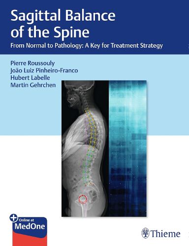 Cover image for Sagittal Balance of the Spine: From Normal to Pathology: A Key for Treatment Strategy