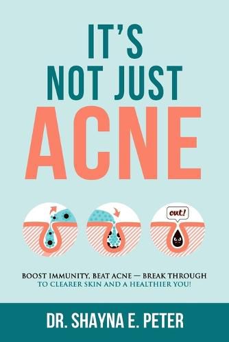 Cover image for It's Not Just Acne: Boost Immunity, Beat Acne - Break Through to Clearer Skin & A Healthier You!