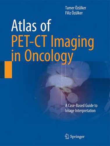 Cover image for Atlas of PET-CT Imaging in Oncology: A Case-Based Guide to Image Interpretation