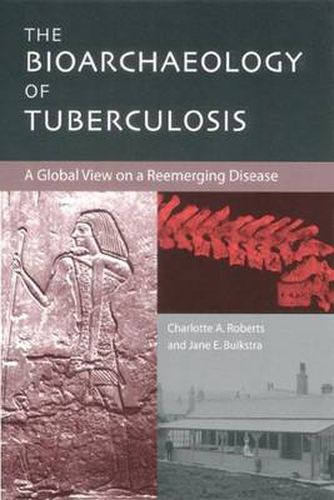 Cover image for The Bioarchaeology of Tuberculosis: A Global View on a Reemerging Disease