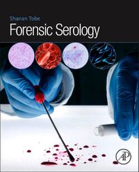 Cover image for Forensic Serology