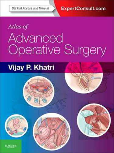 Cover image for Atlas of Advanced Operative Surgery: Expert Consult - Online and Print