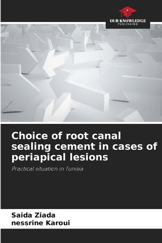 Cover image for Choice of root canal sealing cement in cases of periapical lesions