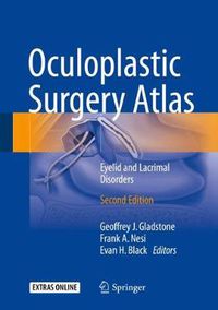 Cover image for Oculoplastic Surgery Atlas: Eyelid and Lacrimal Disorders