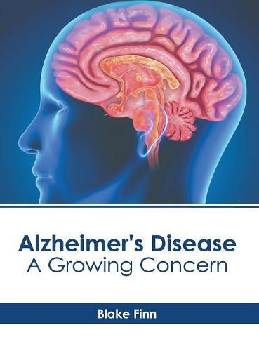 Cover image for Alzheimer's Disease: A Growing Concern