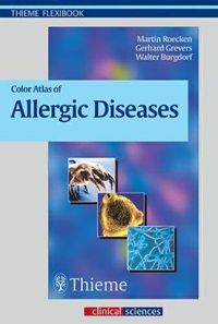 Cover image for Color Atlas of Allergic Diseases