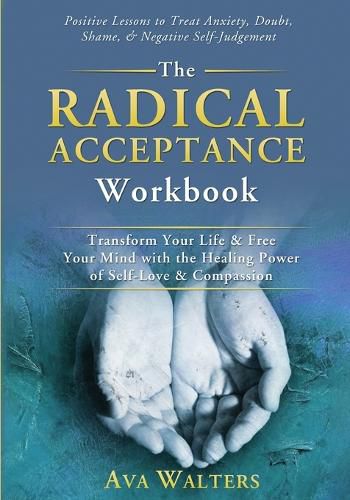 Cover image for The Radical Acceptance Workbook