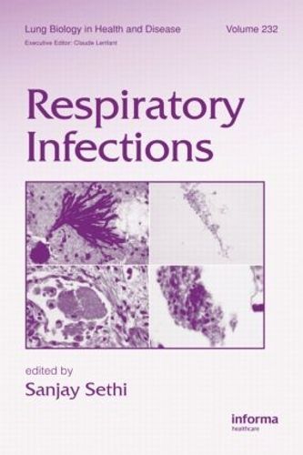 Cover image for Respiratory Infections