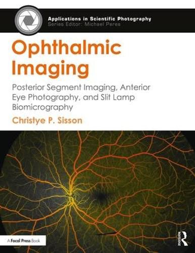 Cover image for Ophthalmic Imaging: Posterior Segment Imaging, Anterior Eye Photography, and Slit Lamp Biomicrography