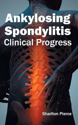 Cover image for Ankylosing Spondylitis: Clinical Progress