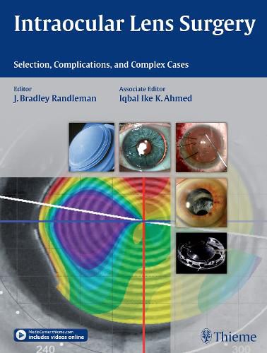 Cover image for Intraocular Lens Surgery: Selection, Complications, and Complex Cases