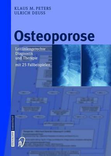 Cover image for Osteoporose: Leitliniengerechte Diagnostik und Therapie mit 25 Fallbeispielen