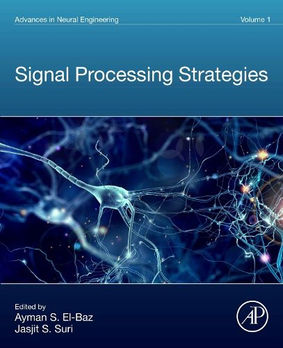 Cover image for Signal Processing Strategies