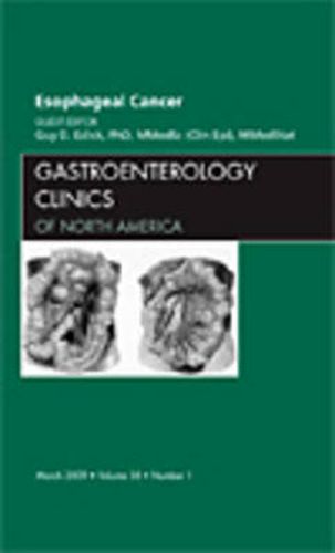 Cover image for Esophageal Cancer, An Issue of Gastroenterology Clinics