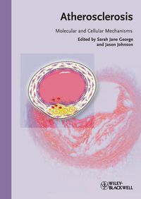 Cover image for Atherosclerosis: Molecular and Cellular Mechanisms