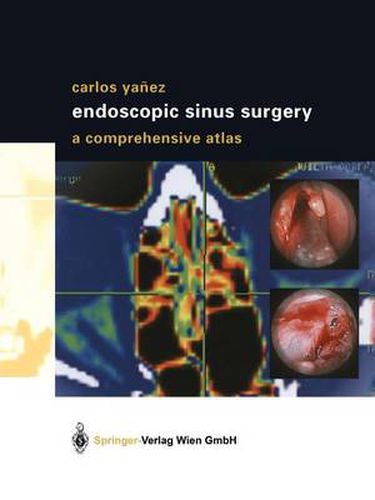 Cover image for Endoscopic Sinus Surgery: A Comprehensive Atlas