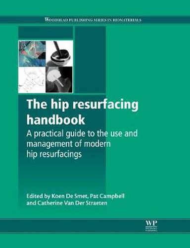 Cover image for The Hip Resurfacing Handbook: A Practical Guide to the Use and Management of Modern Hip Resurfacings