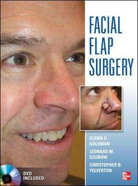 Cover image for Facial Flaps Surgery