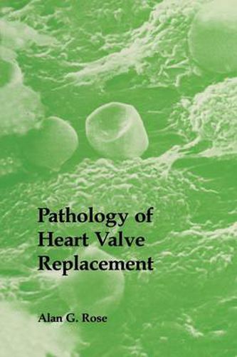 Cover image for Pathology of Heart Valve Replacement