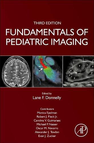 Cover image for Fundamentals of Pediatric Imaging