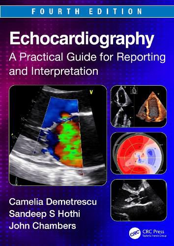Cover image for Echocardiography