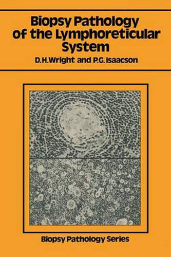 Biopsy Pathology of the Lymphoreticular System