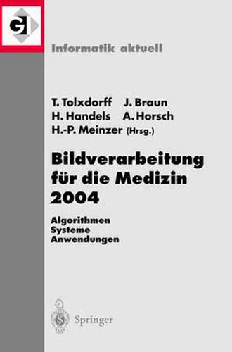 Bildverarbeitung fur die Medizin 2004: Algorithmen, Systeme, Anwendungen