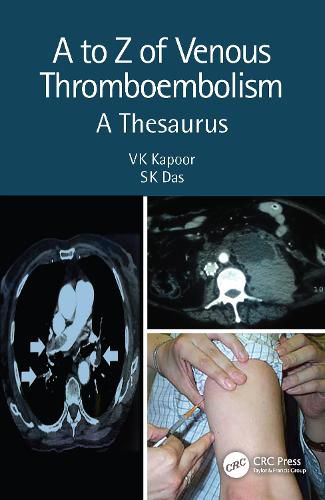 Cover image for A to Z of Venous Thromboembolism: A Thesaurus