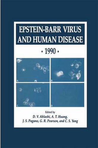 Cover image for Epstein-Barr Virus and Human Disease * 1990