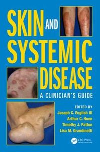 Cover image for Skin and Systemic Disease: A Clinician's Guide