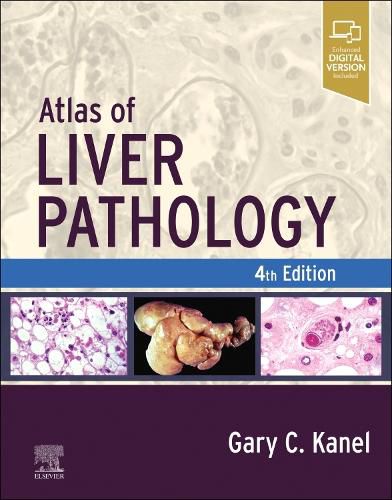 Cover image for Atlas of Liver Pathology