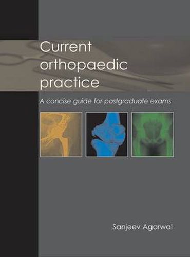 Cover image for Current Orthopaedic Practice: A Concise Guide for Postgraduate Exams